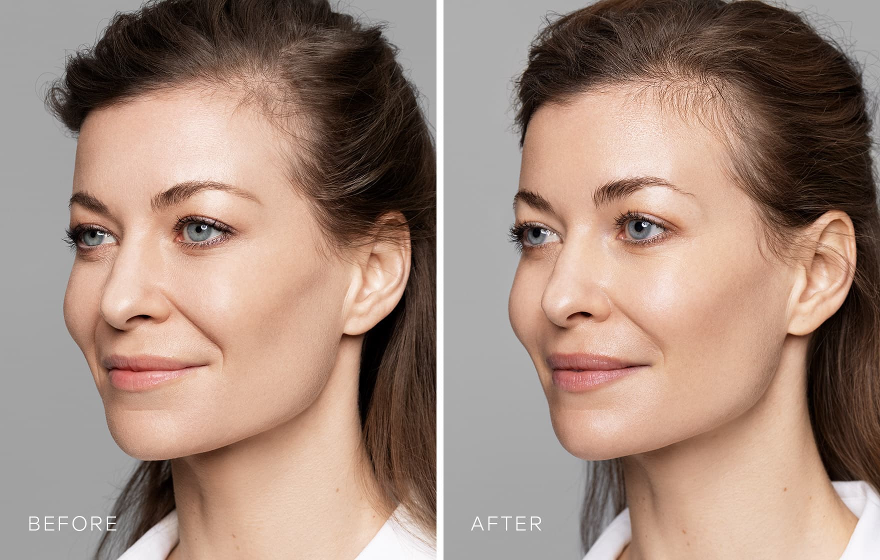 Fühlen sich die Lippen mit HA-Lip Filler natürlich an oder nicht