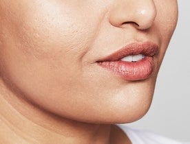 Consumer_V3_Skinboosters_Face_BAsmall_Rafat_After