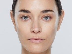 Restylane_CategoryPage_BABanner_Georgia_Before