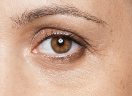 Dunkle Ringe unter den Augen