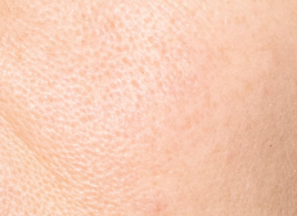 Hauttextur