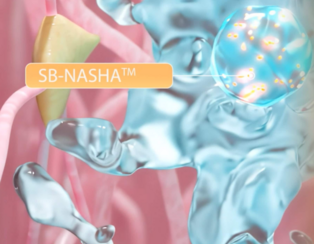 Die Wissenschaft hinter Restylane® Skinboosters™