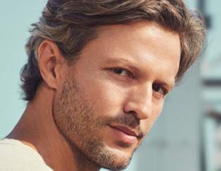 Hyaluronsäure-Filler für die Jawline