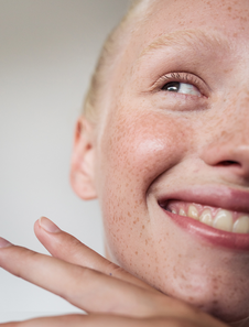 redness-night-moisturizer