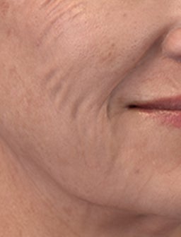 Drehen Sie die Uhr für straffere Haut zurück