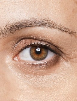 Dunkle Augenringe: ein häufiges Problem für viele